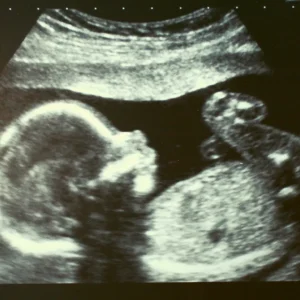 baby in buik echo